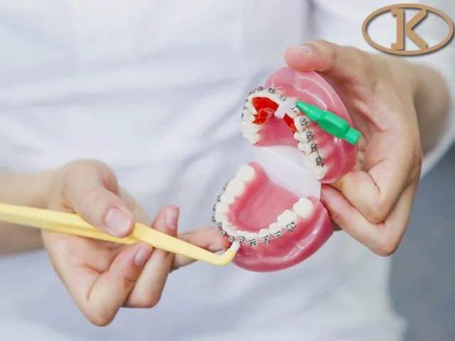 Thủ thuật khác